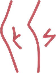 Muscle Weakness or Atrophy